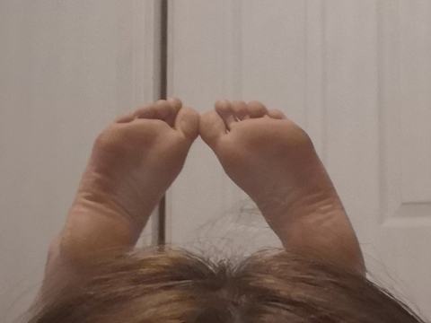 feetfungusfoot onlyfans leaked picture 1